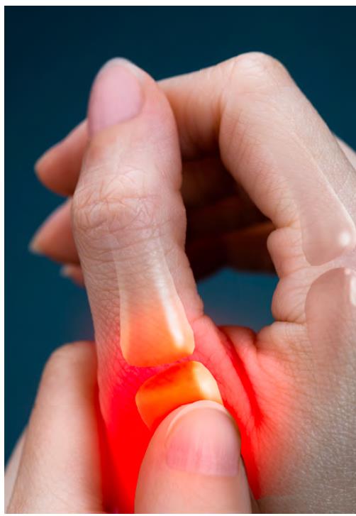 douleur doigts arthrose